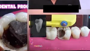 dental