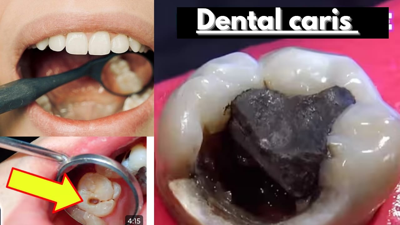 dental